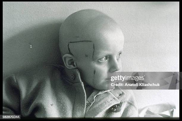 Vladimir, aged 7, suffering from cancer, in the hospital in Minsk.