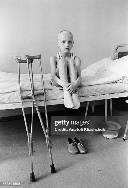 Anna, aged 9, suffering from bone cancer at Borovliany Hospital. She awaits amputation of her left foot.