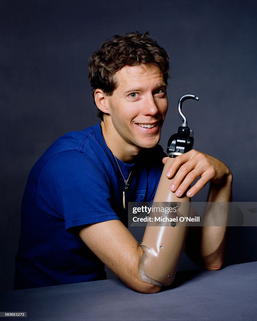 Mountaineer Aron Ralston Wears A Prosthetic Hook After Amputating His mountaineer-aron-ralston-wears-a-prosthetic-hook-after-amputating-his