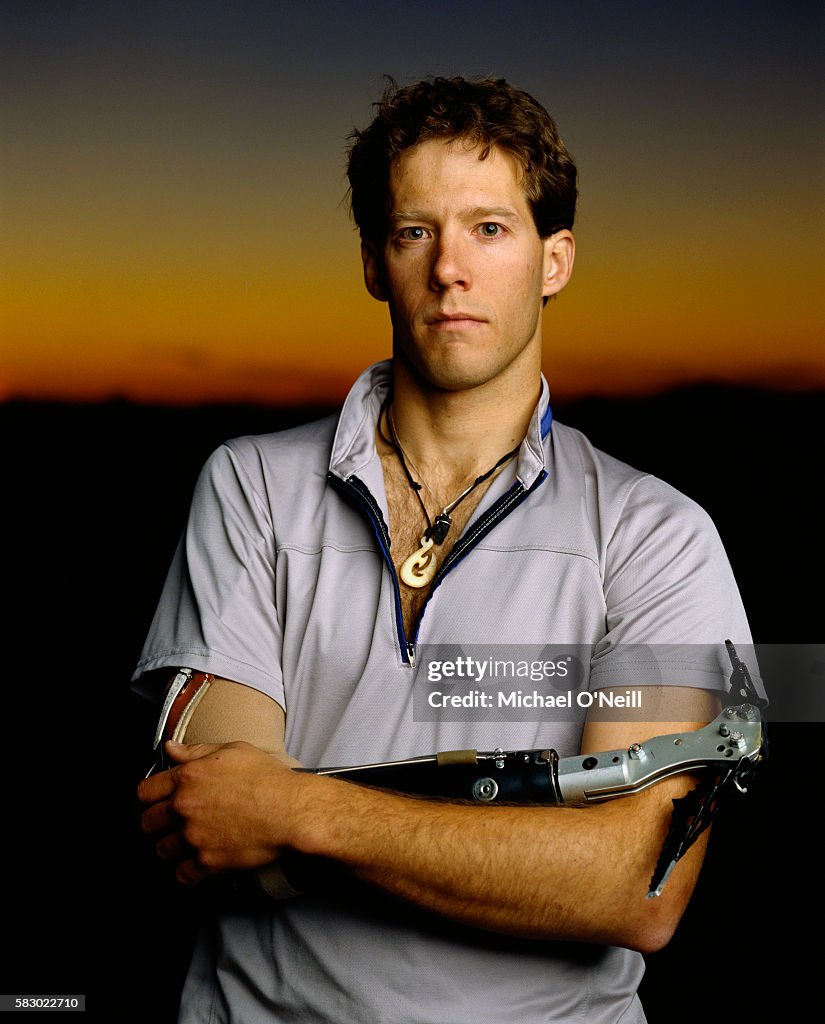 Aron Rlaston Mountaineer Aron Ralston wears a prosthetic hook after amputating his ...