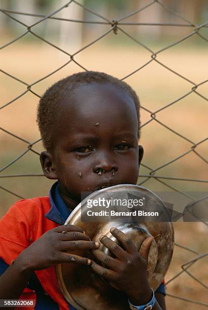 Child receives food and medical treatment at a refugee camp in Juba, Sudan. Widespread famine and civil war have ravaged Sudan for decades, resulting...