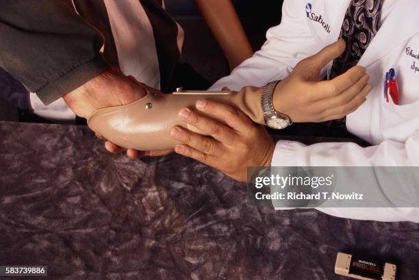 fitting a man with an artificial arm - artificial arm stock pictures, royalty-free photos & images