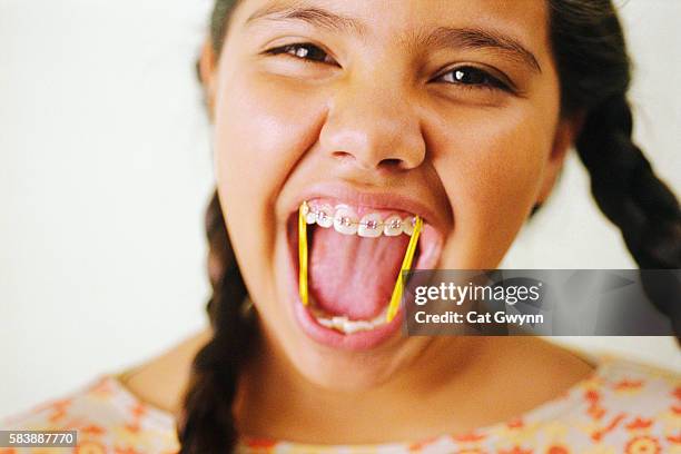smiling girl wearing braces - dentista bambini foto e immagini stock