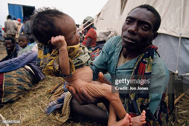 Bébé souffrant du choléra dans le camp de Munigi.