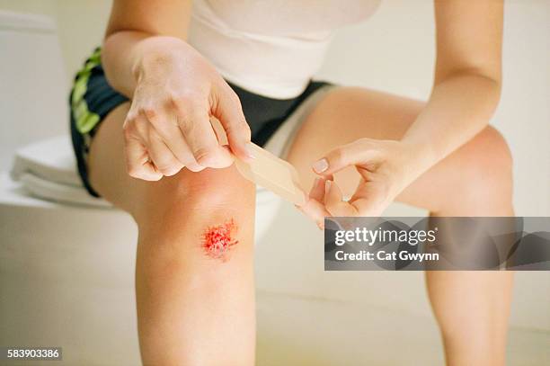 bandaging a scraped knee - wounded photos et images de collection