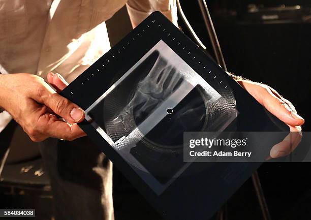 Alexander Hacke, bassist and former guitarist for German industrial/experimental band Einstuerzende Neubauten, shows an x-ray vinyl recording of his...