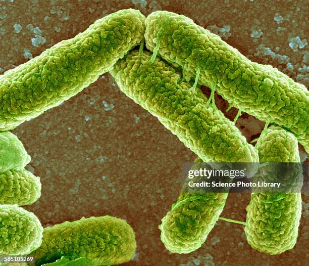 e coli bacteria, sem - microscopia eletrônica de varredura - fotografias e filmes do acervo