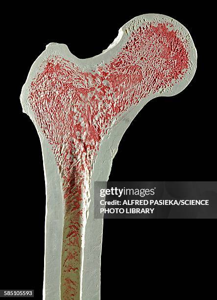 upper right femur leg bone - femur stock illustrations