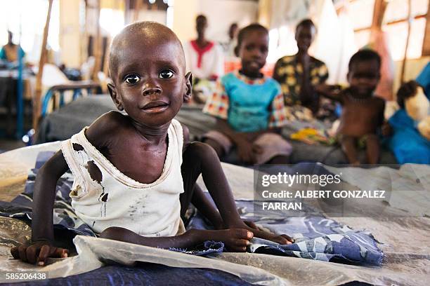 Aleo Tong , who suffers severe malnutrition, rests on a bed at the MSF Nutrition centre in Aweil Hospital, on 2 August, 2016. The low rainfall in...