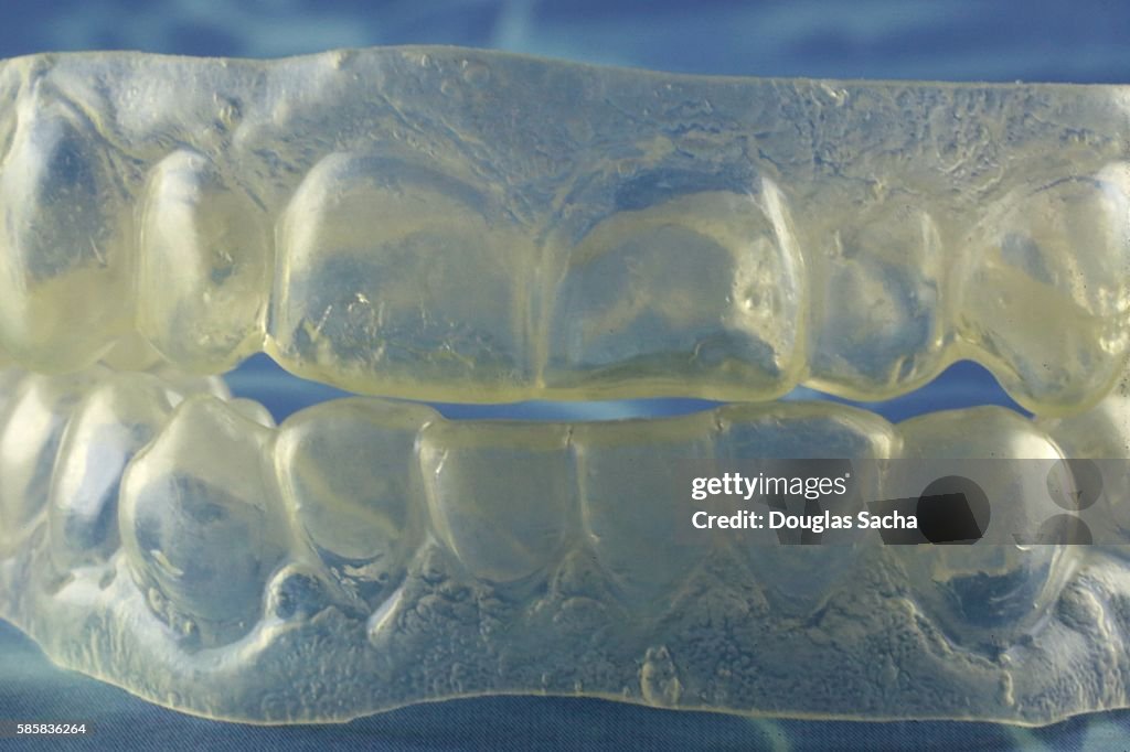 Teeth whitening inserts for bleaching application