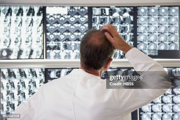 radiologist scratching his head while looking at diagnostic images - radiogram photographic image fotografías e imágenes de stock