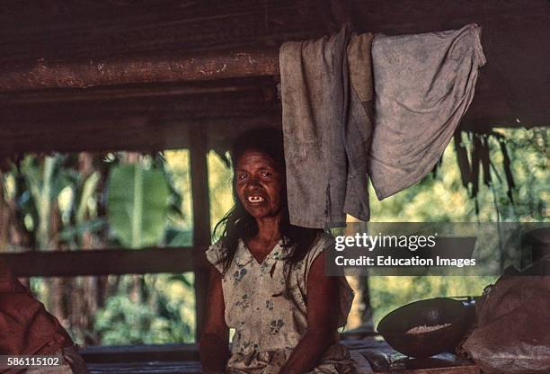 Ticuna Indian woman -rumored cannibal habit of filing canine teeth and pulling others for fierce look, Colombian Amazon, 1970.