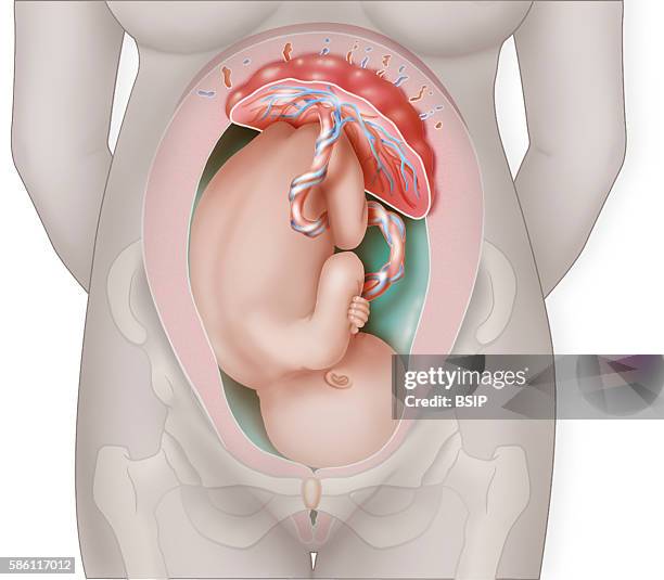 Illustration of a f'tus in the uterus in the 9th month of pregnancy, with the head down, its umbilical cord and placenta seen prominently. The...