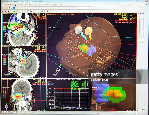 Reportage at the Rinecker Proton Therapy Center in Munich, Germany. The center has the latest equipment for proton therapy treatment. Proton therapy...