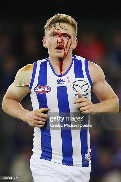 Jack Ziebell of the Kangaroos comes off injured during the round 20 AFL match between the Western Bulldogs and the North Melbourne Kangaroos at...