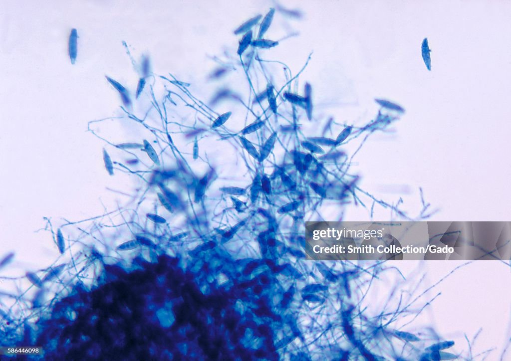 Microsporum Gypseum