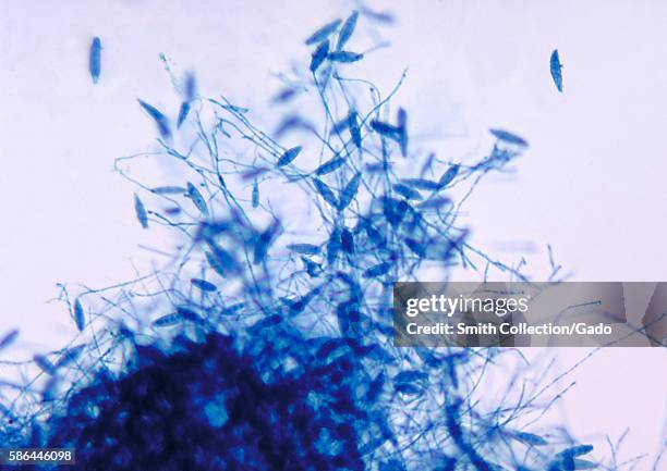 This is a photomicrograph of the fungus Microsporum gypseum using the lactophenol cotton blue staining technique, 1969. The dermatophyte M. Gypseum,...