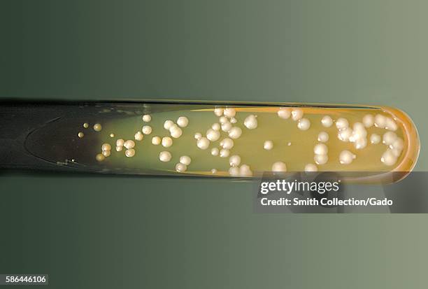 This SABHI agar slant culture is growing Cryptococcus neoforman grown at 37 C, 1974. Life-threatening infections caused by the encapsulated fungal...