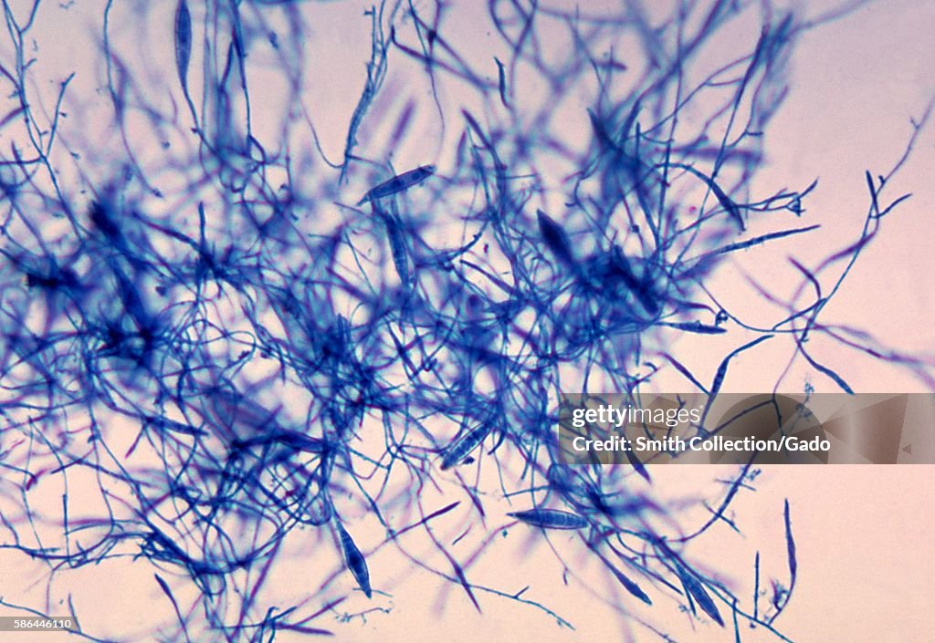 Microsporum Canis