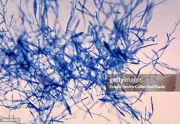 This is a photomicrograph of the fungus Microsporum canis using the lactophenol cotton blue staining technique, 1969. M. Canis, a zoophilic...