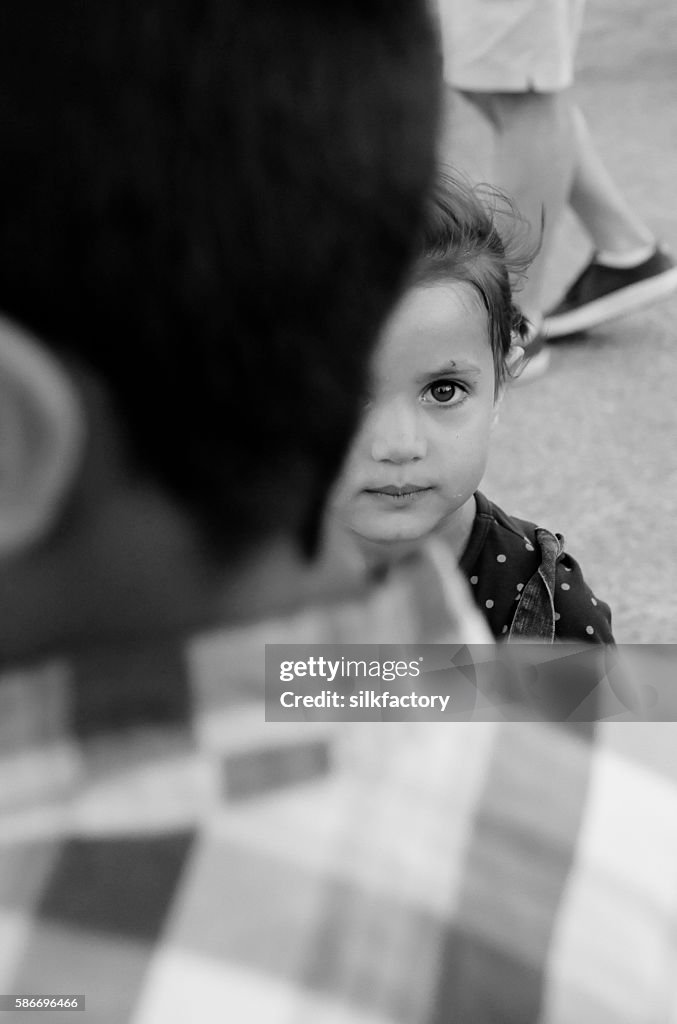 Refugee girl recovering from chickenpox