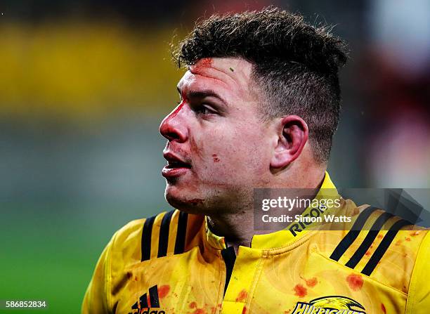Ricky Riccitelli of the Hurricanes leaves the field with a blood injury during the 2016 Super Rugby Final match between the Hurricanes and the Lions...