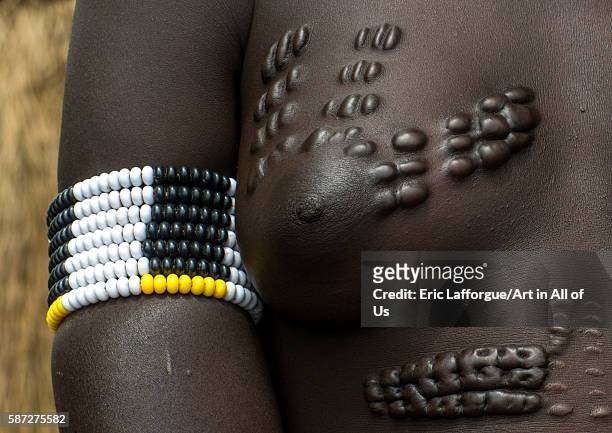 Scarified breast of a mursi tribe woman, omo valley, mago park, Ethiopia on March 18, 2016 in Mago Park, Ethiopia.