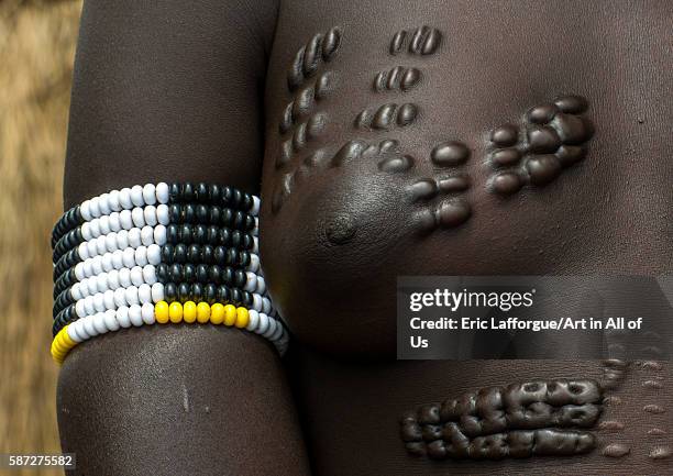 Scarified breast of a mursi tribe woman, omo valley, mago park, Ethiopia on March 18, 2016 in Mago Park, Ethiopia.