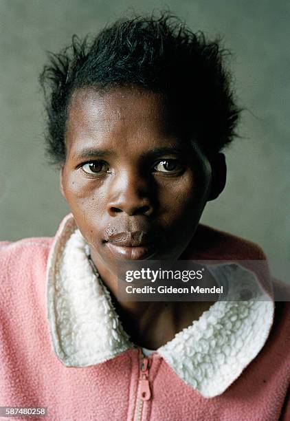 Nomphilo Mazuza looks directly at the camera two months after starting her ARV medication for AIDS. She had begun her ARV treatment with a severely...