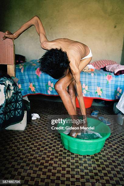 Two months after starting her ARV medication, HIV-Positive mother Nomphilo Mazuza bathes. She had begun her ARV treatment with a severely compromised...