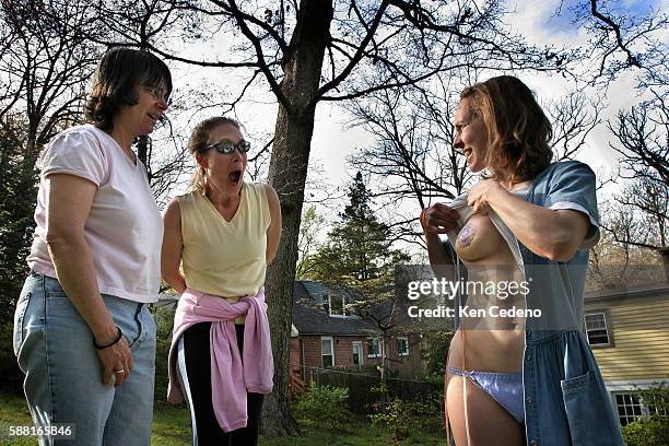 Patrice Gilbert and Sue DeLettera react as Kathleen Byran shows them her right breast a 4-5 days following reconstructive surgery with Dr. Bernard...