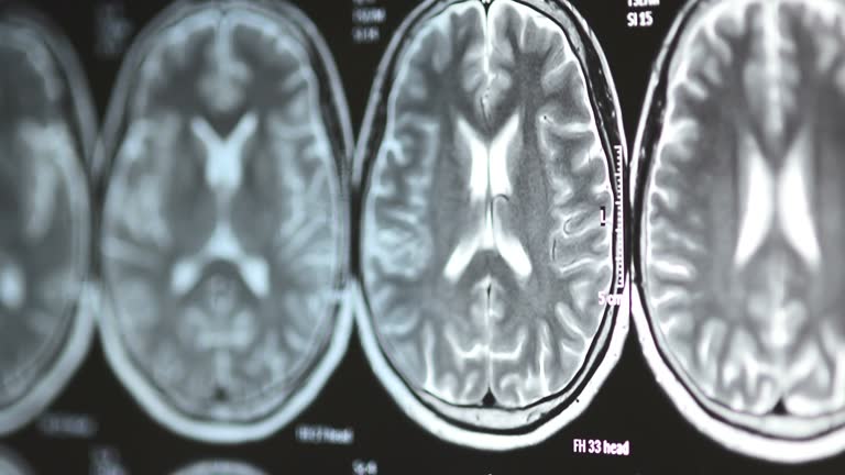 Insect Mri 11 Insect Xray Stock Videos, Footage, & 4K Video Clips - Getty Images