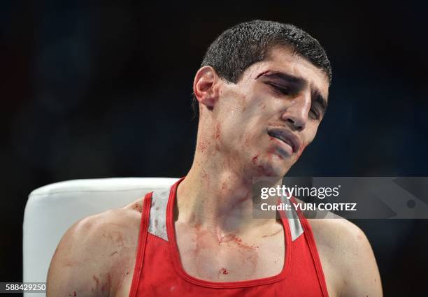 Blood stained Armenia's Vladimir Margaryan reacts after losing against Cuba's Roniel Iglesias during the Men's Welter match at the Rio 2016 Olympic...