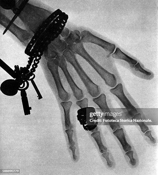 This is one of the first X-ray photographs taken in the UK to a woman's hand with ring, bracelet and a chain with keys. Wilhelm Conrad Roentgen...