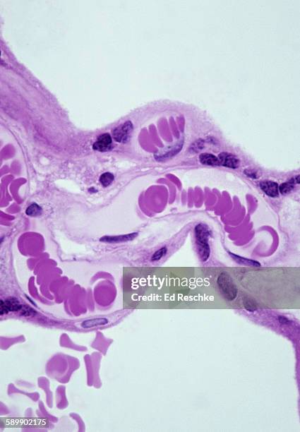 capillaries with red blood cells in rouleaux - endothelial stock pictures, royalty-free photos & images