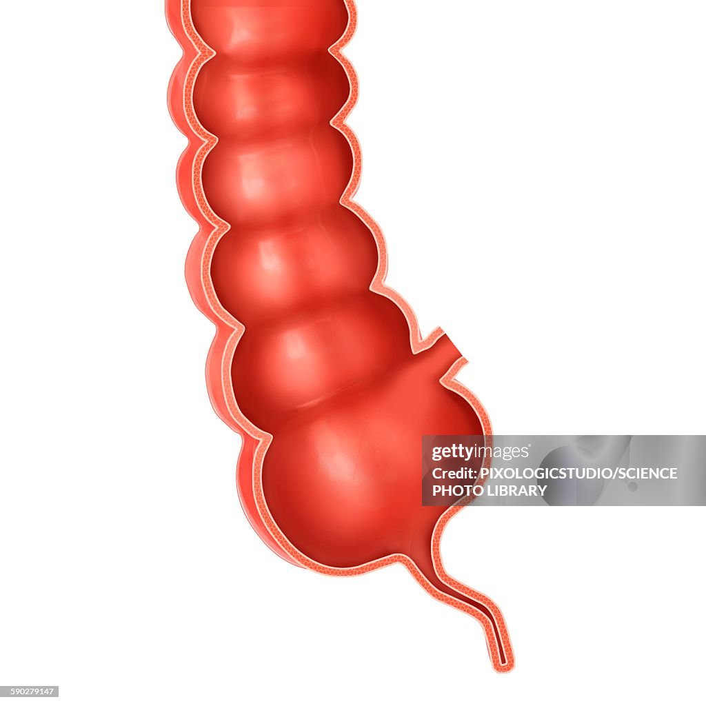 Human Appendix Illustration High-Res Vector Graphic - Getty Images