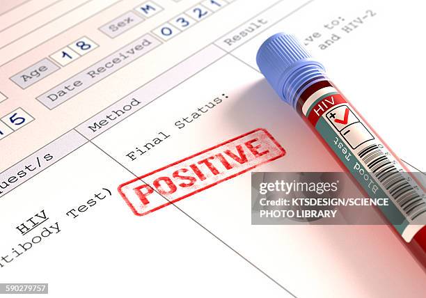 ilustraciones, imágenes clip art, dibujos animados e iconos de stock de positive hiv blood test, illustration - material de vidrio de laboratorio
