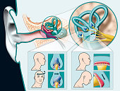 Vestibular system