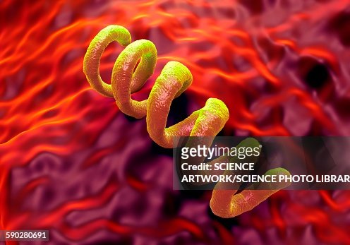 61 Ilustraciones de Sifilis - Getty Images