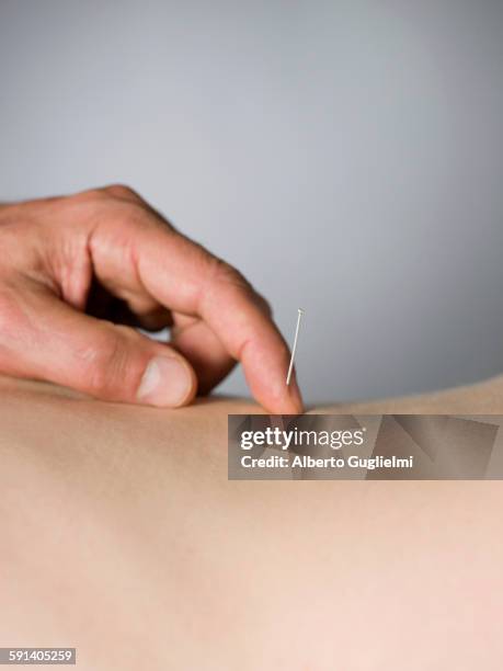 close up of acupuncturist checking needle in back of patient - acupuncture elderly stock pictures, royalty-free photos & images