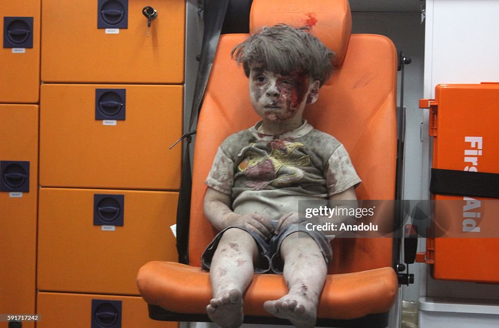 Wounded Syrian Kid Omran Daqneesh