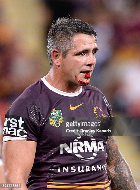 Corey Parker of the Broncos is bleeding from the mouth during the round 24 NRL match between the Brisbane Broncos and the Canterbury Bulldogs at...