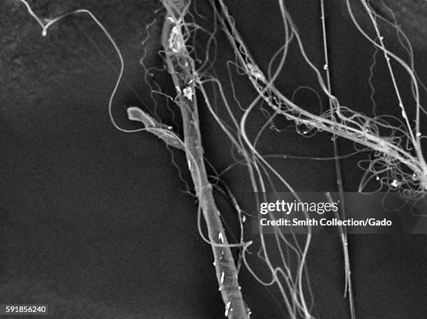 Silk Threads Microscope 28 Nano Microscope Stock Photos, High-Res Pictures, and Images - Getty ...