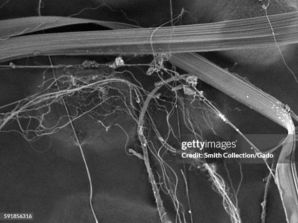 Silk Threads Microscope 300x Photos and Premium High Res Pictures - Getty Images