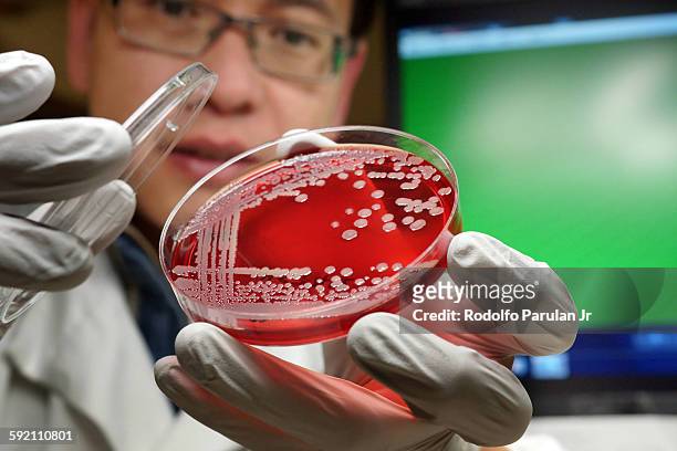 man holding a culture plate of mrsa bacteria - メチシリン耐性黄色ブドウ球菌 ストックフォトと画像