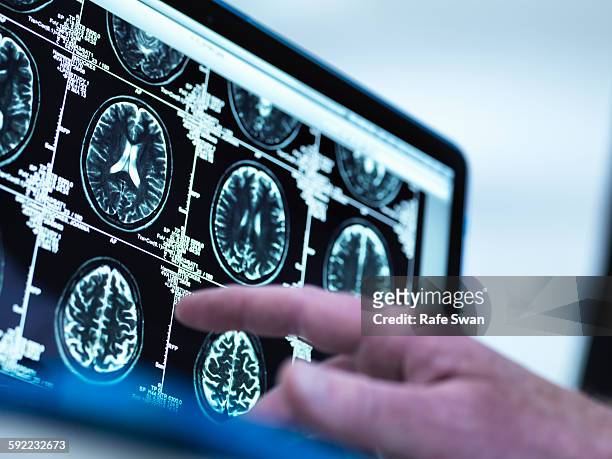 doctor viewing a series of mri (magnetic resonance imaging) brain scans on a screen - brain food photos et images de collection