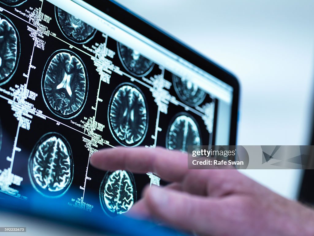 Doctor viewing a series of MRI (Magnetic Resonance Imaging) brain scans on a screen
