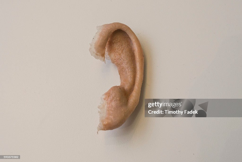 Prostatic Ear A prosthetic ear on display at the 3D printing show, held at... News ...