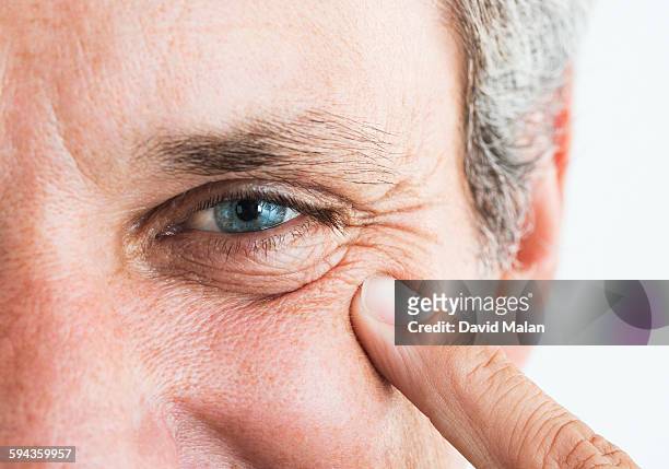 man pointing to wrinkles around his eye - smiling mature eyes stockfoto's en -beelden