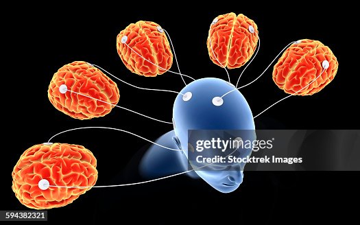 Brain Multple Conceptual Image Of Multibrain Processing High-Res Vector Graphic ...
